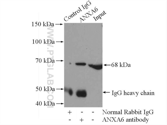 Annexin VI Antibody in Immunoprecipitation (IP)