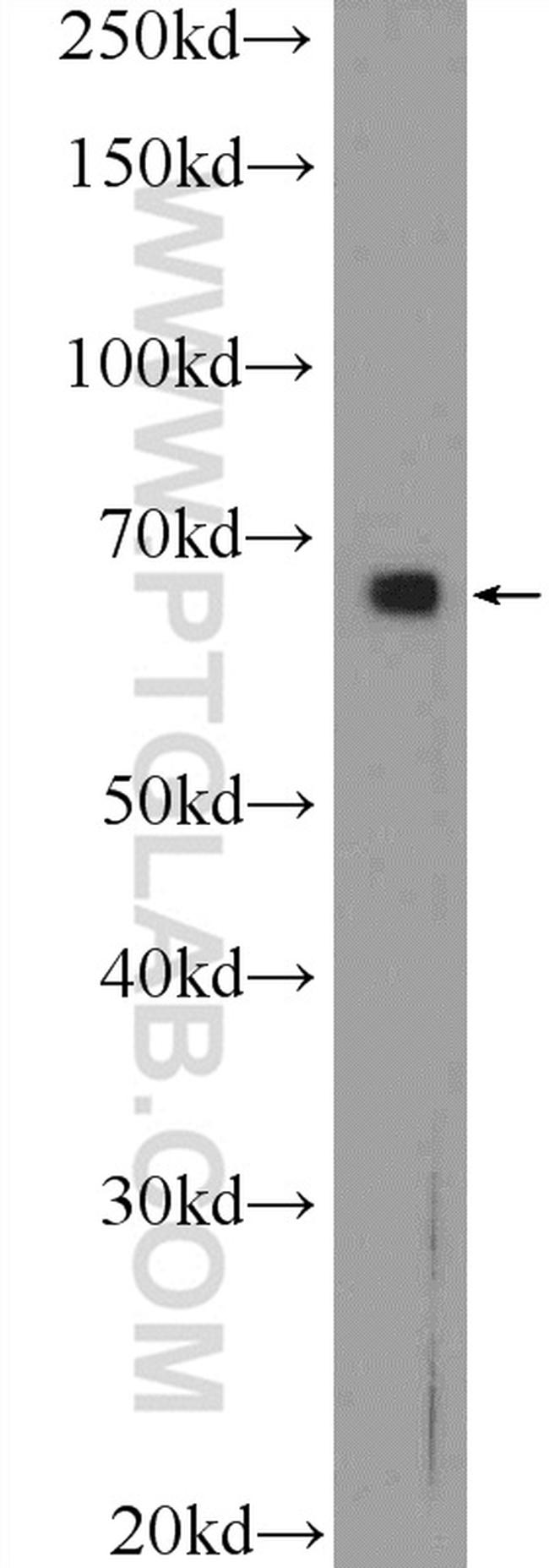 Annexin VI Antibody in Western Blot (WB)