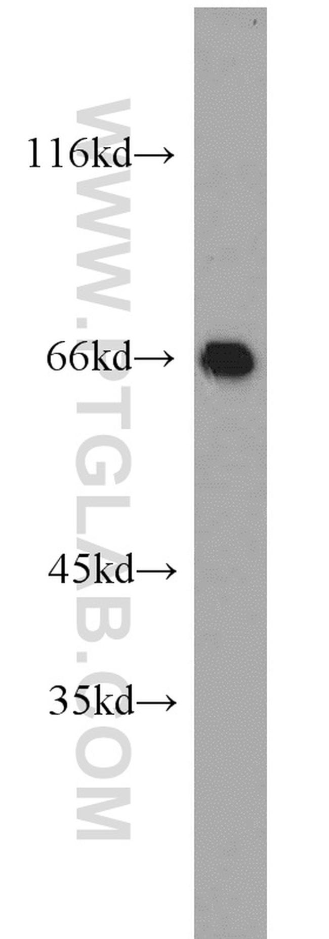 Annexin VI Antibody in Western Blot (WB)