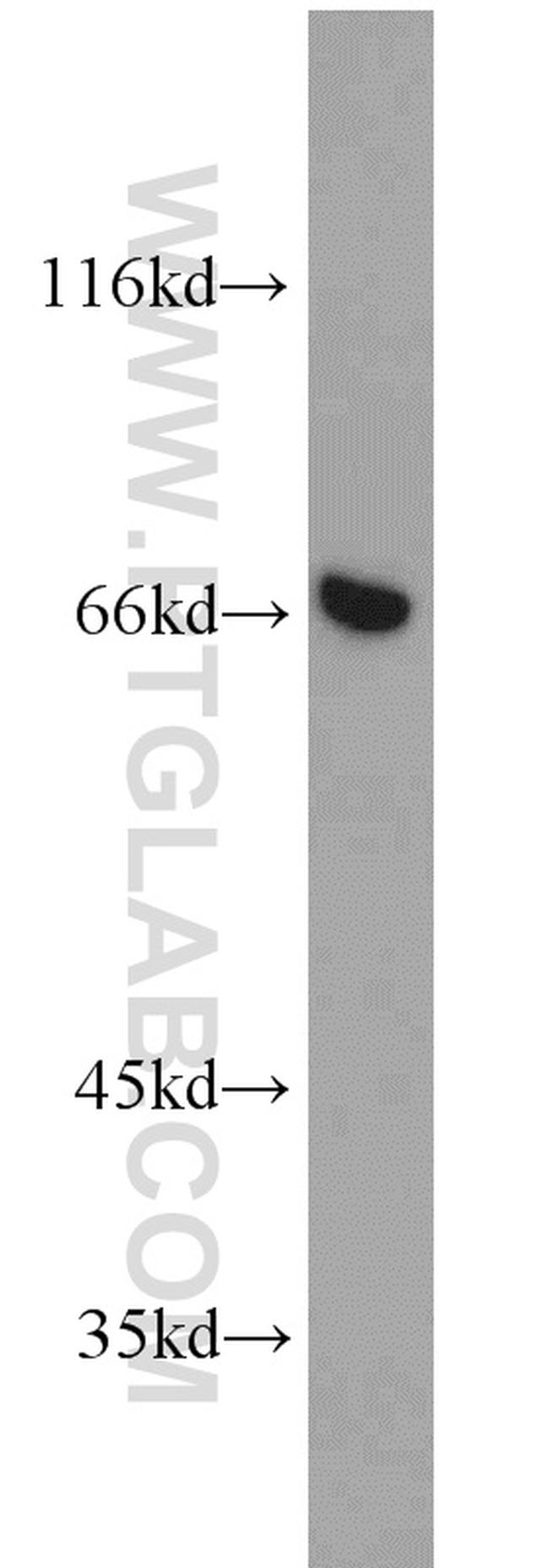 Annexin VI Antibody in Western Blot (WB)