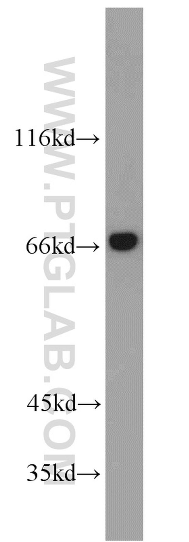 Annexin VI Antibody in Western Blot (WB)