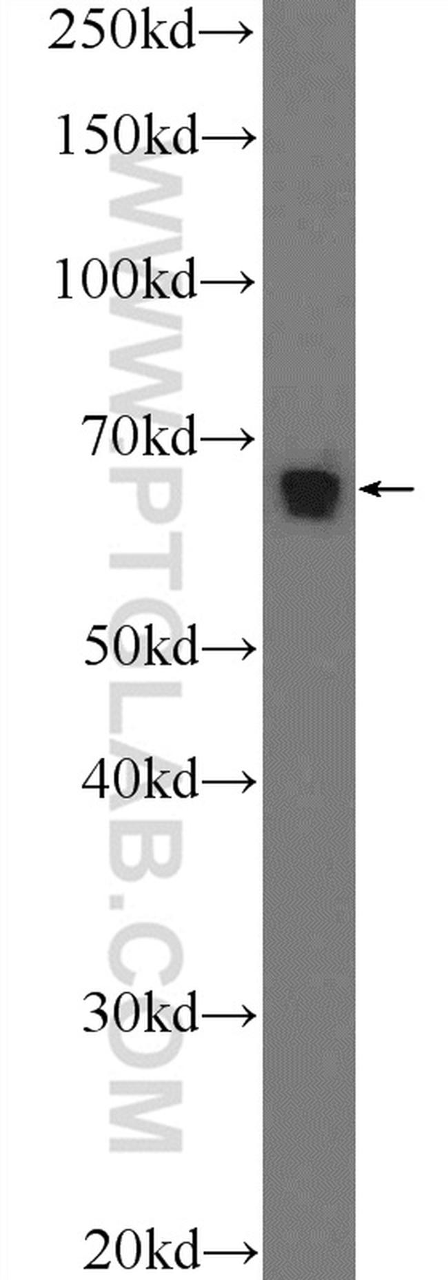 Annexin VI Antibody in Western Blot (WB)