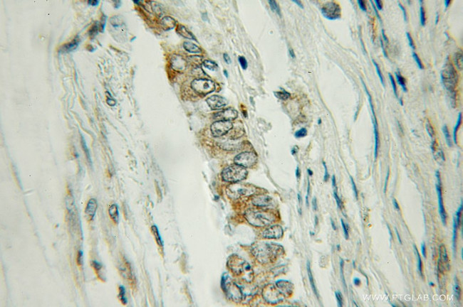 TRIM31 Antibody in Immunohistochemistry (Paraffin) (IHC (P))