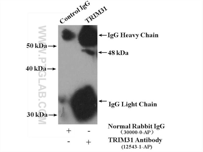 TRIM31 Antibody in Immunoprecipitation (IP)