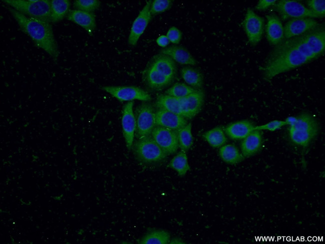 SQLE Antibody in Immunocytochemistry (ICC/IF)