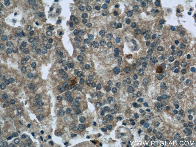 SQLE Antibody in Immunohistochemistry (Paraffin) (IHC (P))