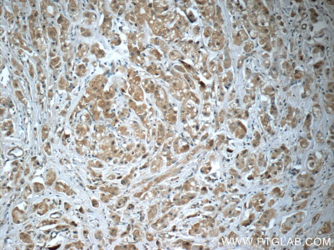 SQLE Antibody in Immunohistochemistry (Paraffin) (IHC (P))