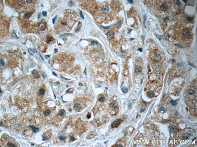 SQLE Antibody in Immunohistochemistry (Paraffin) (IHC (P))