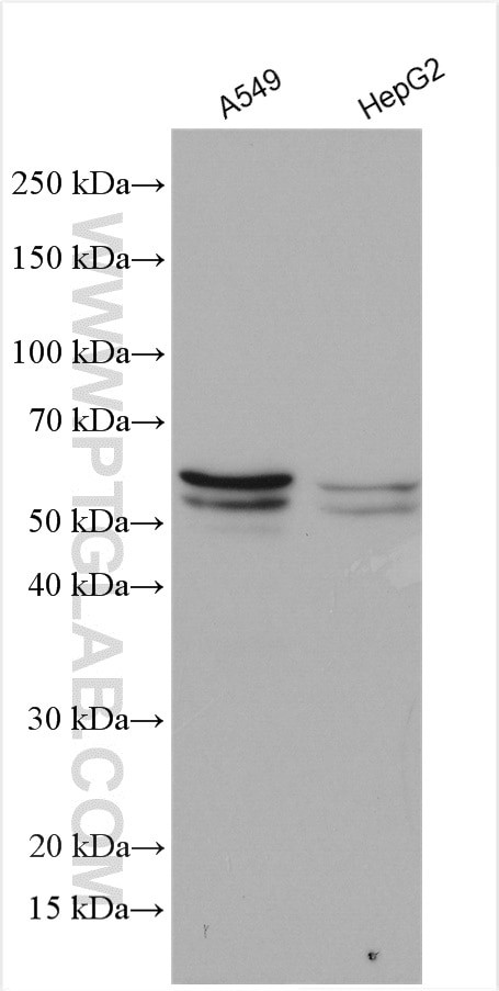 SQLE Antibody in Western Blot (WB)