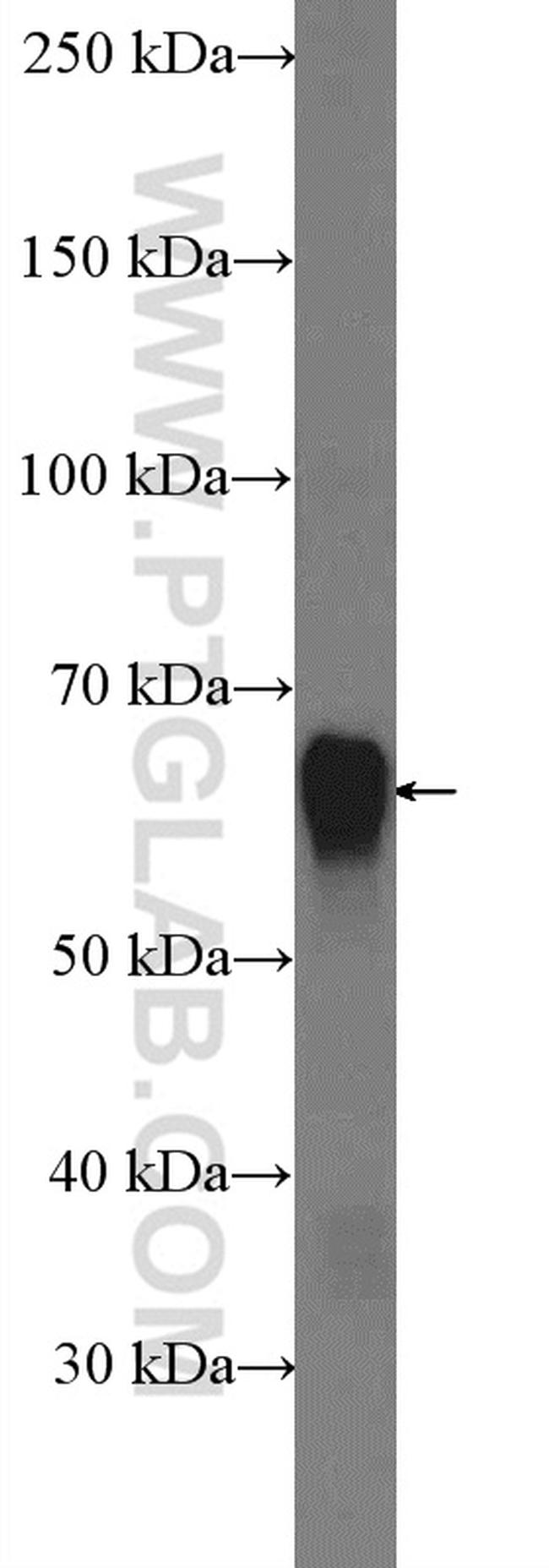 SQLE Antibody in Western Blot (WB)