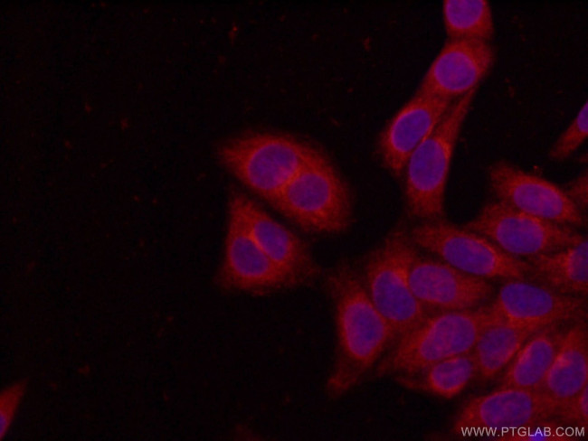 PEX5 Antibody in Immunocytochemistry (ICC/IF)