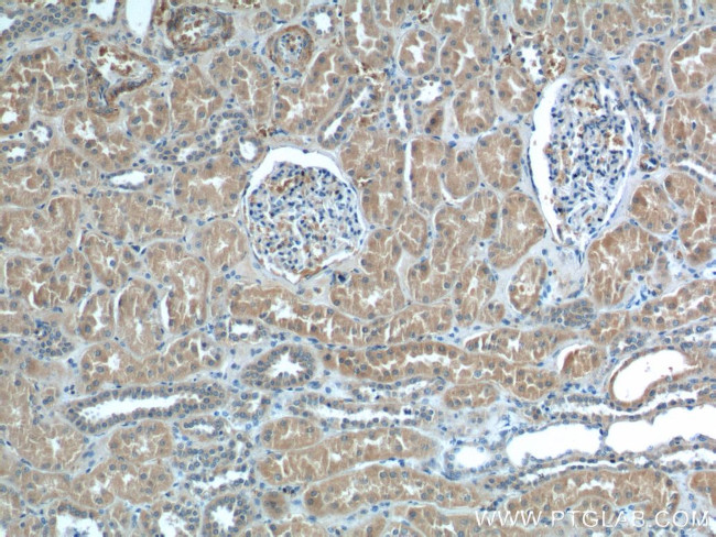 PEX5 Antibody in Immunohistochemistry (Paraffin) (IHC (P))