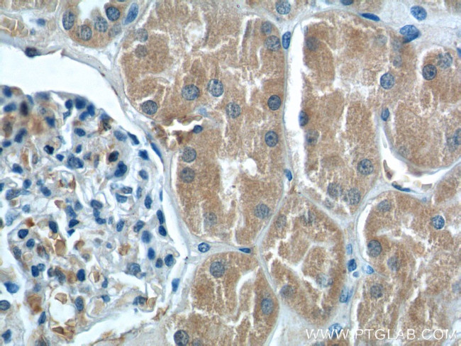 PEX5 Antibody in Immunohistochemistry (Paraffin) (IHC (P))