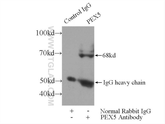 PEX5 Antibody in Immunoprecipitation (IP)