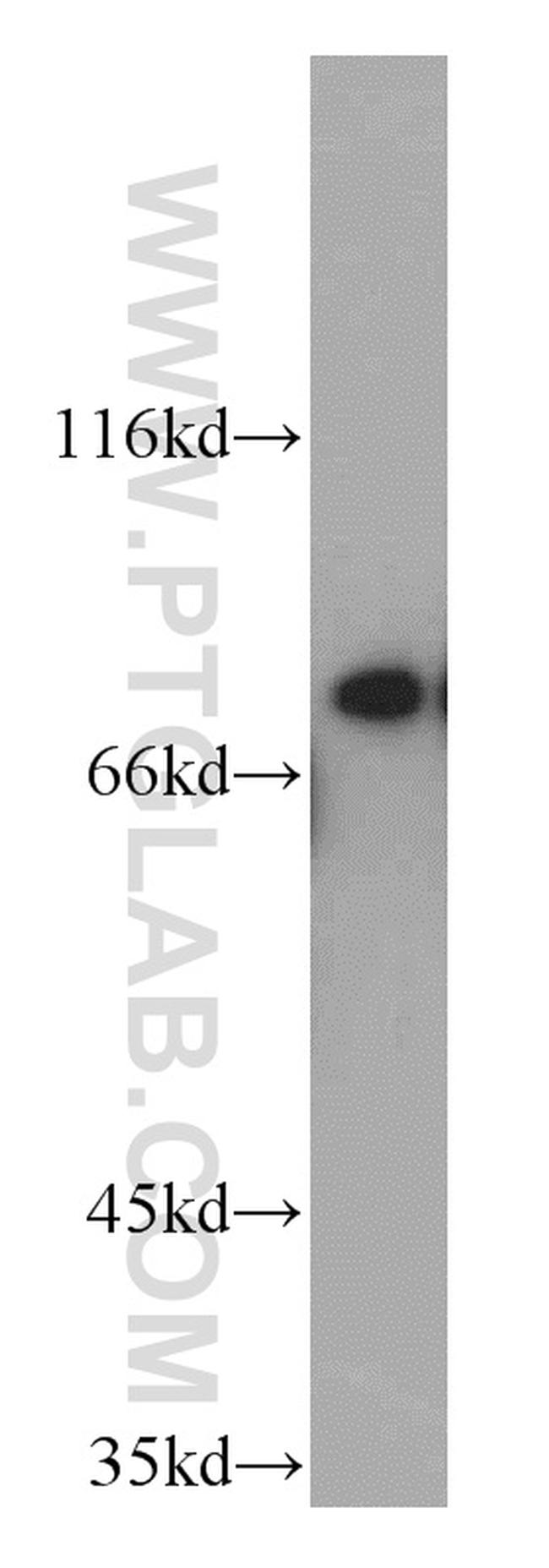 PEX5 Antibody in Western Blot (WB)