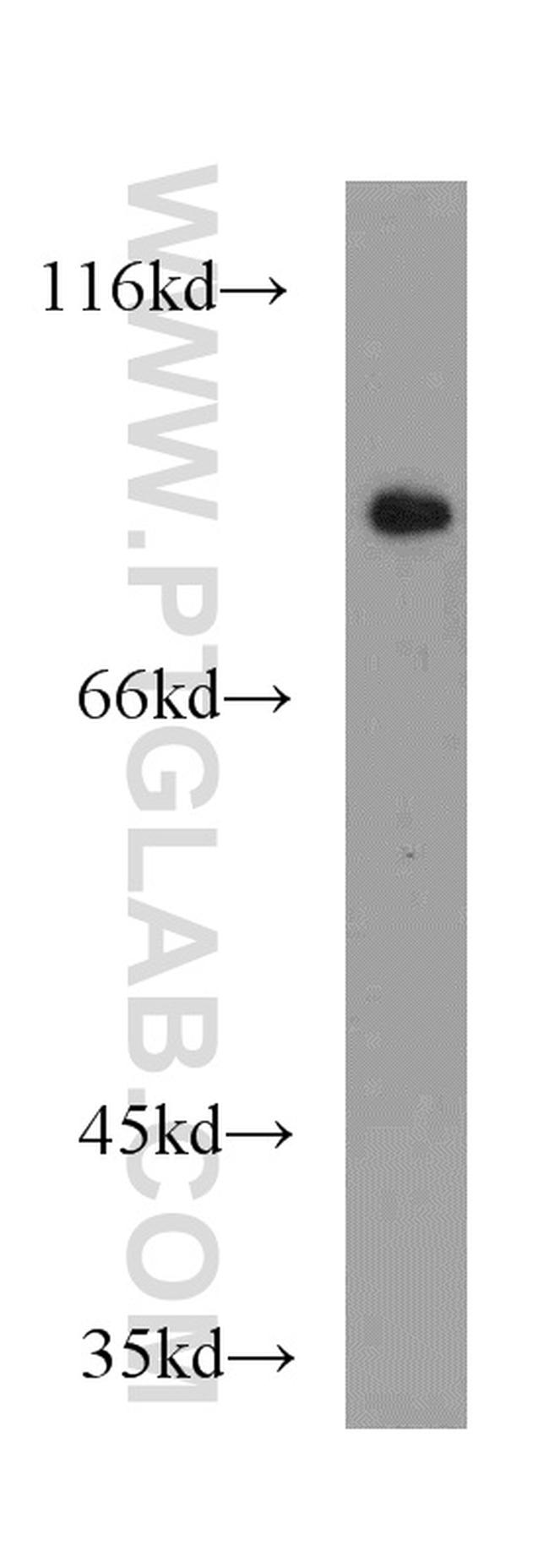 PEX5 Antibody in Western Blot (WB)