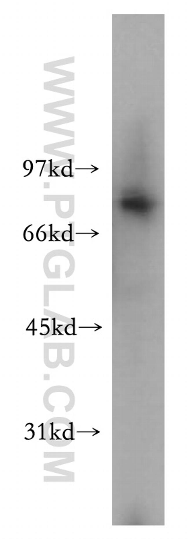 PEX5 Antibody in Western Blot (WB)