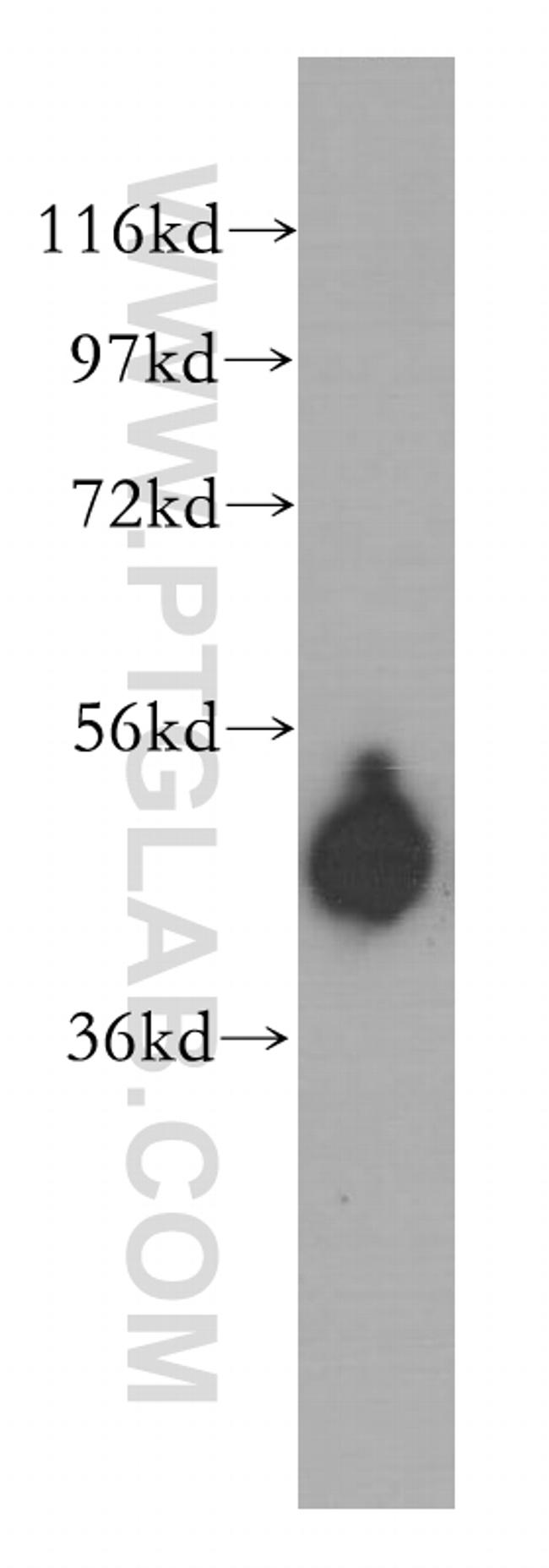 CPVL Antibody in Western Blot (WB)