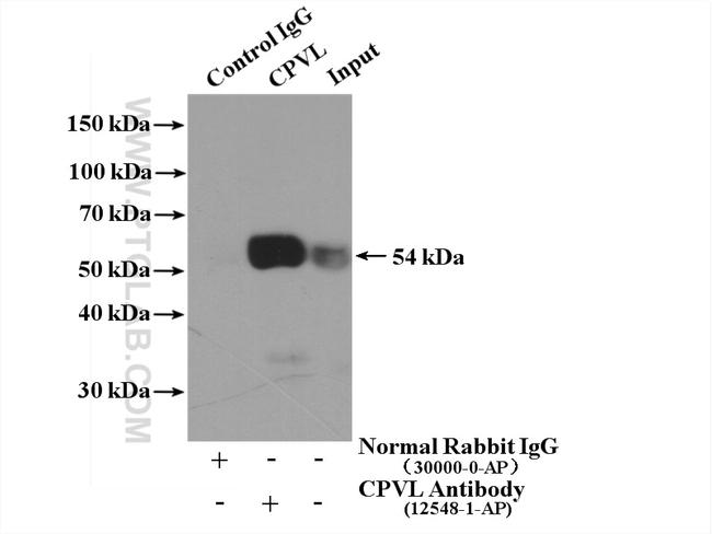CPVL Antibody in Western Blot (WB)