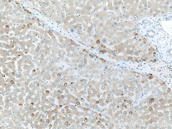 Factor XII Antibody in Immunohistochemistry (Paraffin) (IHC (P))