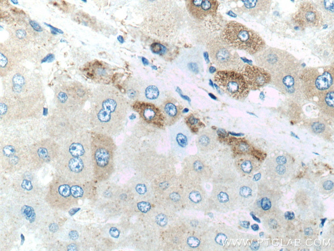 Factor XII Antibody in Immunohistochemistry (Paraffin) (IHC (P))