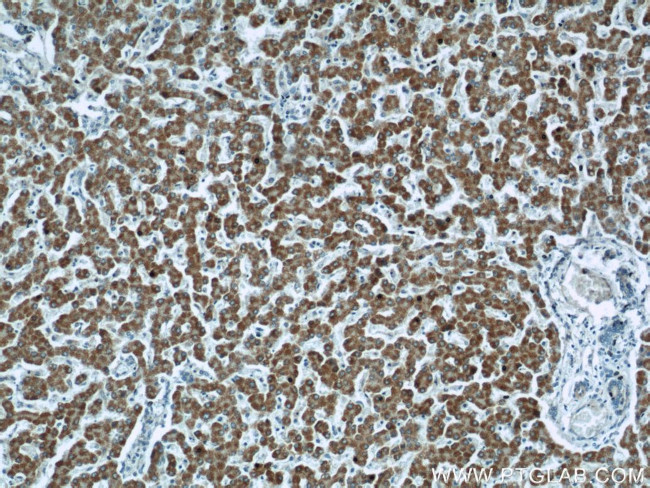 Factor XII Antibody in Immunohistochemistry (Paraffin) (IHC (P))