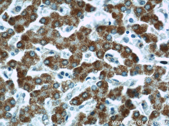 Factor XII Antibody in Immunohistochemistry (Paraffin) (IHC (P))