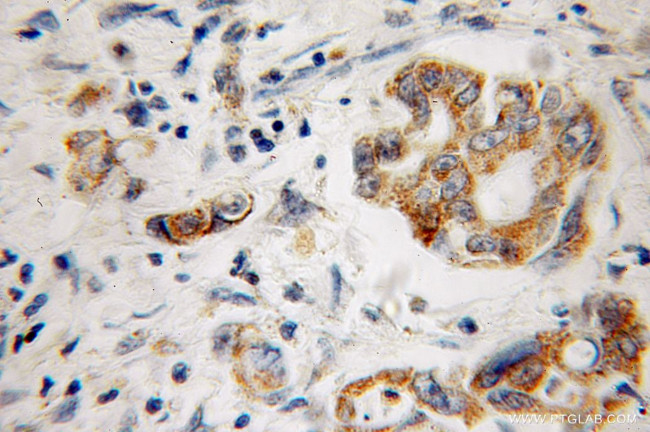 Factor XII Antibody in Immunohistochemistry (Paraffin) (IHC (P))