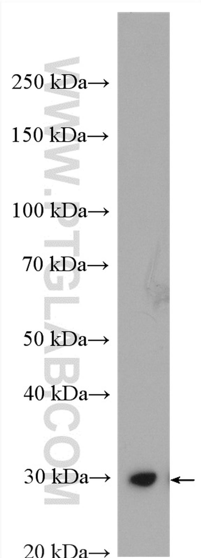 Factor XII Antibody in Western Blot (WB)