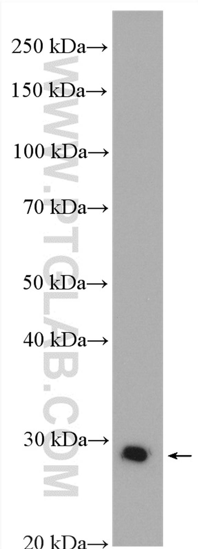 Factor XII Antibody in Western Blot (WB)