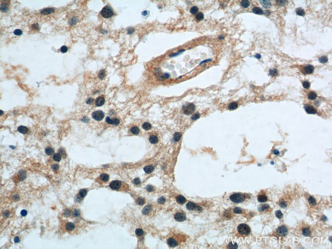 PrP Antibody in Immunohistochemistry (Paraffin) (IHC (P))