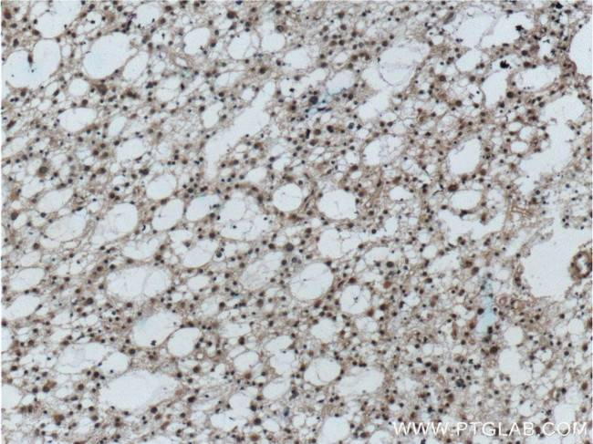 PrP Antibody in Immunohistochemistry (Paraffin) (IHC (P))