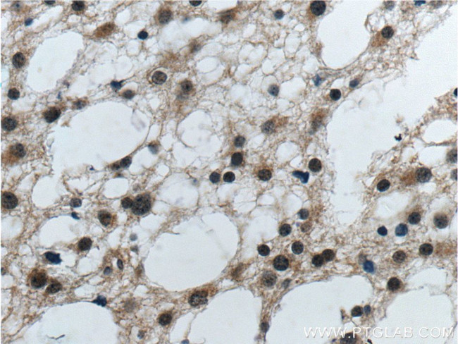 PrP Antibody in Immunohistochemistry (Paraffin) (IHC (P))