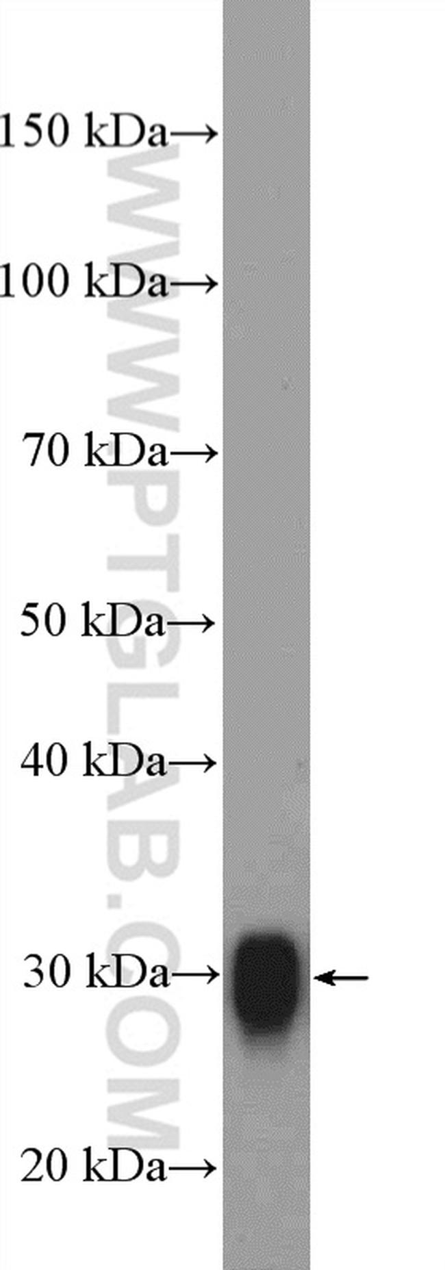 PrP Antibody in Western Blot (WB)