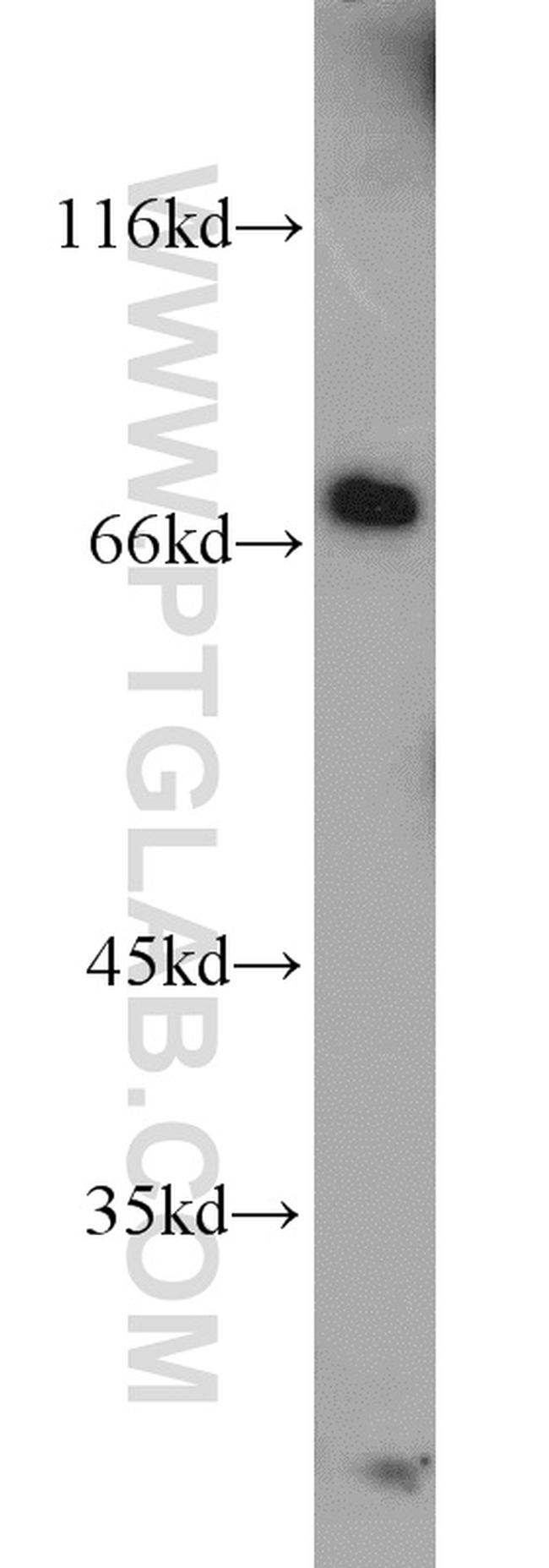 RAPGEF5 Antibody in Western Blot (WB)