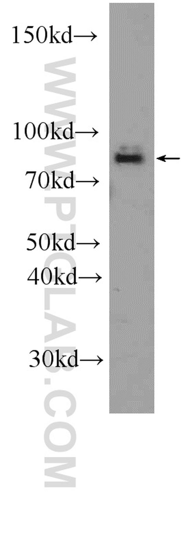 RAPGEF5 Antibody in Western Blot (WB)