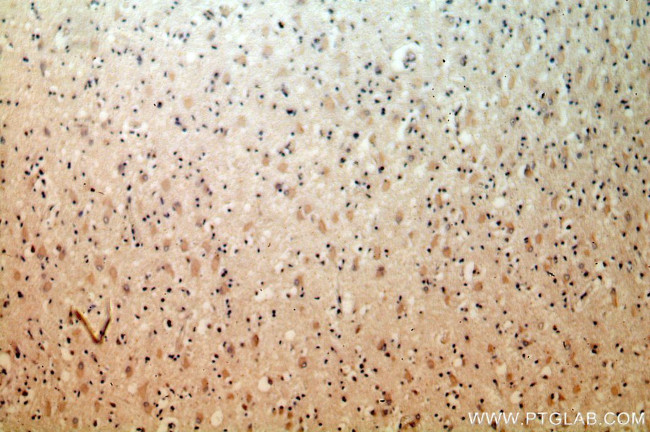 PRMT8 Antibody in Immunohistochemistry (Paraffin) (IHC (P))