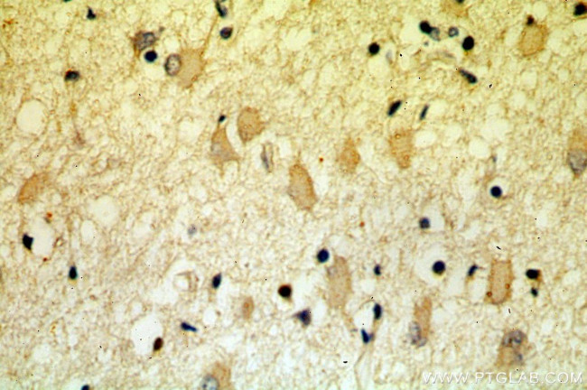 PRMT8 Antibody in Immunohistochemistry (Paraffin) (IHC (P))