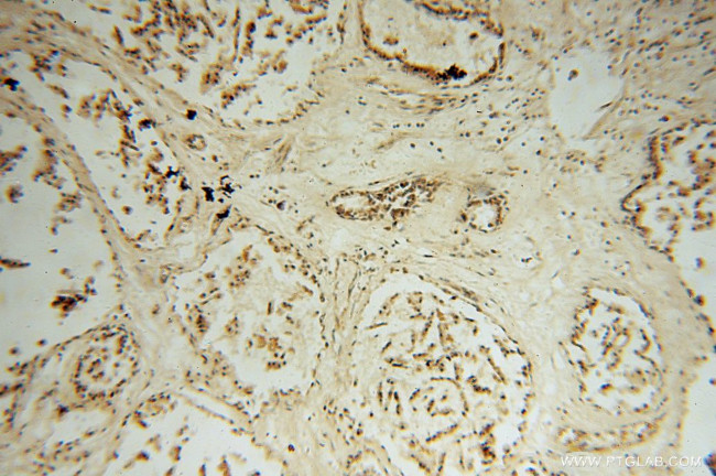 STK36 Antibody in Immunohistochemistry (Paraffin) (IHC (P))