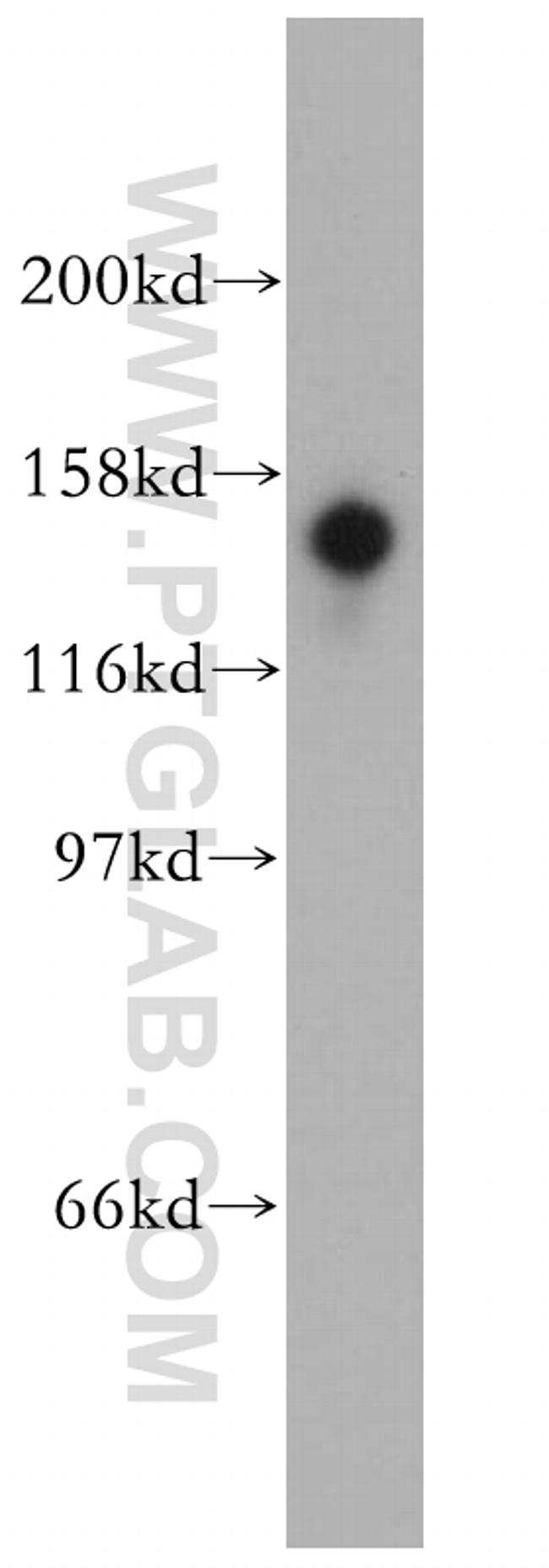 STK36 Antibody in Western Blot (WB)