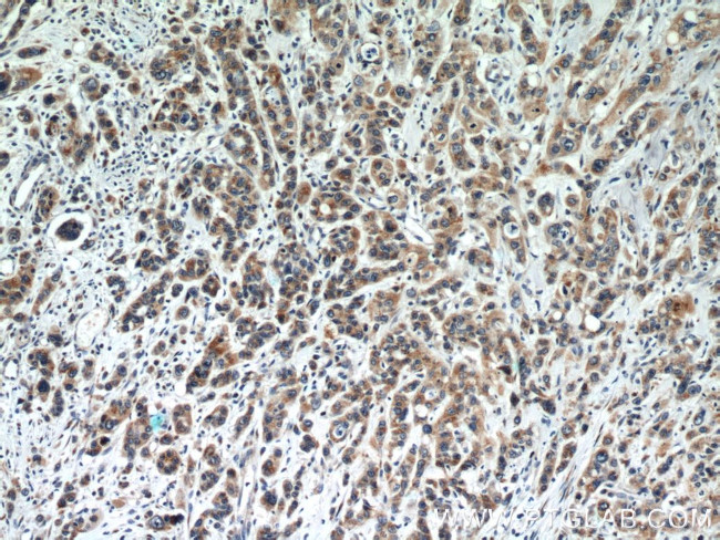 FUT8 Antibody in Immunohistochemistry (Paraffin) (IHC (P))