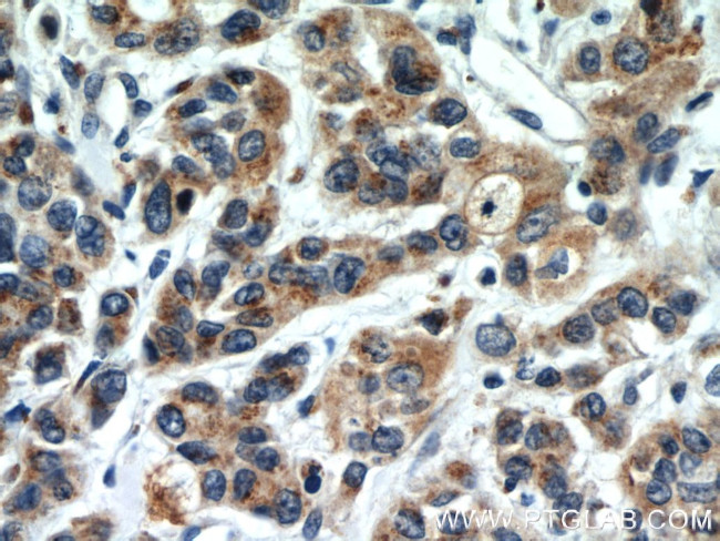 FUT8 Antibody in Immunohistochemistry (Paraffin) (IHC (P))