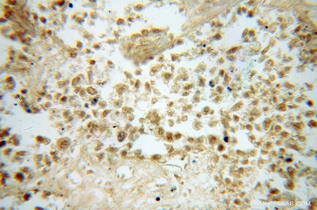 FUT8 Antibody in Immunohistochemistry (Paraffin) (IHC (P))