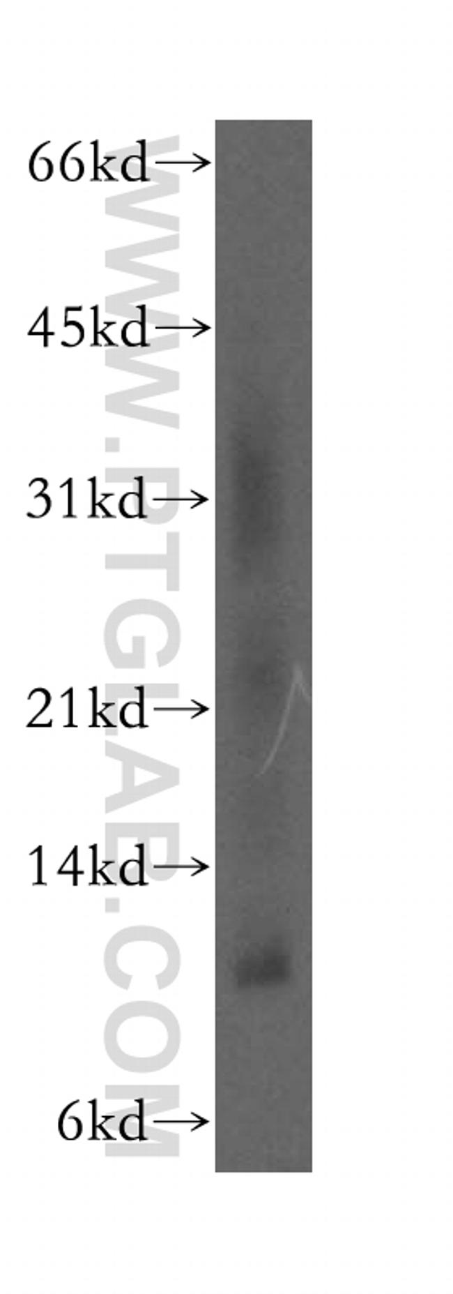 SELK Antibody in Western Blot (WB)