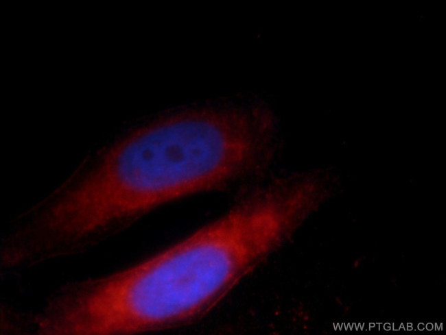 CNOT4 Antibody in Immunocytochemistry (ICC/IF)