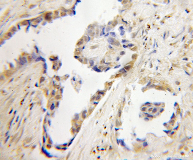 CNOT4 Antibody in Immunohistochemistry (Paraffin) (IHC (P))