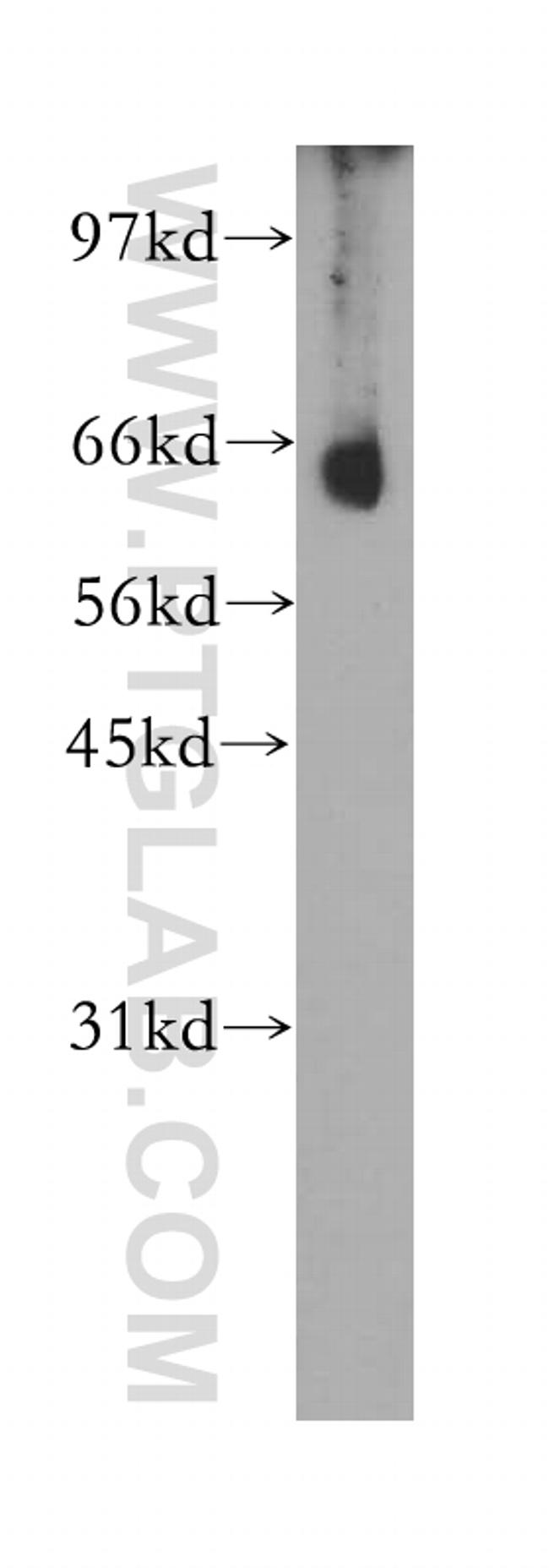 CNOT4 Antibody in Western Blot (WB)