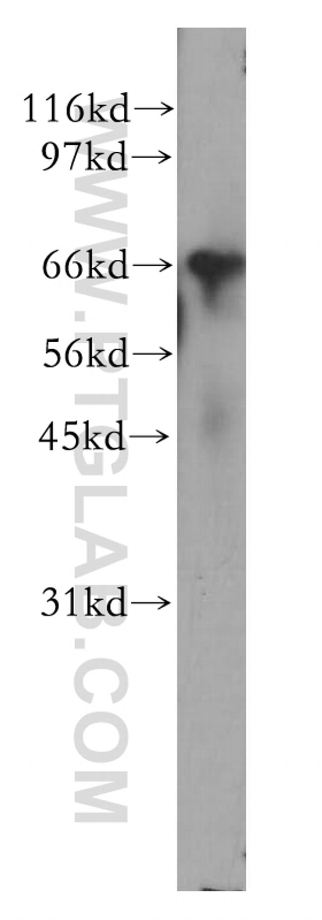 CNOT4 Antibody in Western Blot (WB)