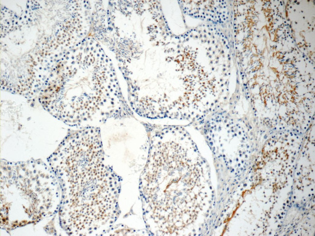 ROPN1L Antibody in Immunohistochemistry (Paraffin) (IHC (P))