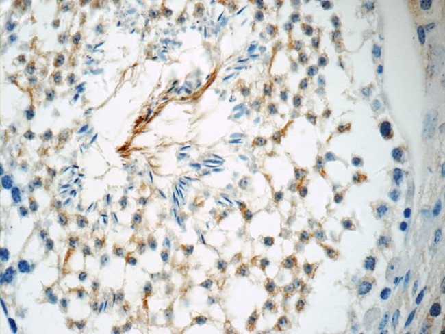 ROPN1L Antibody in Immunohistochemistry (Paraffin) (IHC (P))